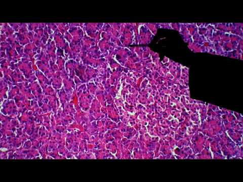 Histology of the Pancreas