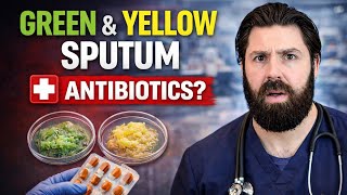 Yellow or Green Mucus Doctor Explains Why You Probably Don’t Need Antibiotics 