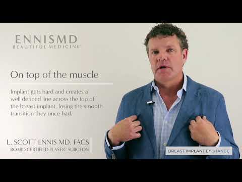 Breast Implant Exchange with L  Scott Ennis, MD, FACS
