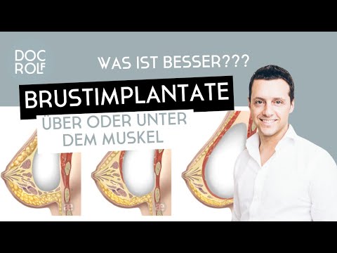 BRUSTIMPLANTATE über oder UNTER DEM MUSKEL??? Dr. Rolf Bartsch