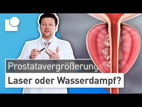 Laser surgery or Rezūm water vapor ablation? - The right treatment for enlarged prostate (BPH)