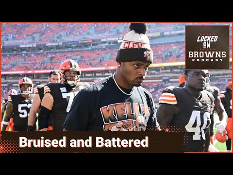 Bruised and Battered and the Bully 49ers come to Cleveland