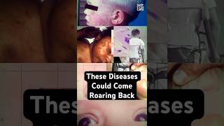 Stanford study models disease deaths if vaccine supply halts under RFK Jr. health leadership