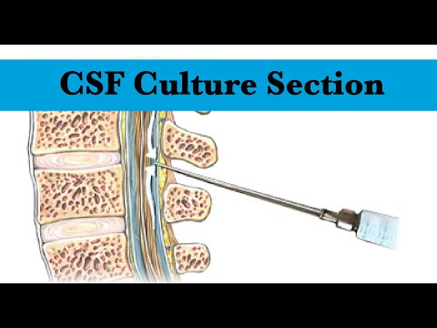 Cerebrospinal Fluid (CSF) culture Section by ASM Minds Team