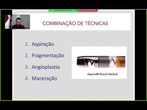 Intervencao no TEP maciço: trombólise x trombectomia