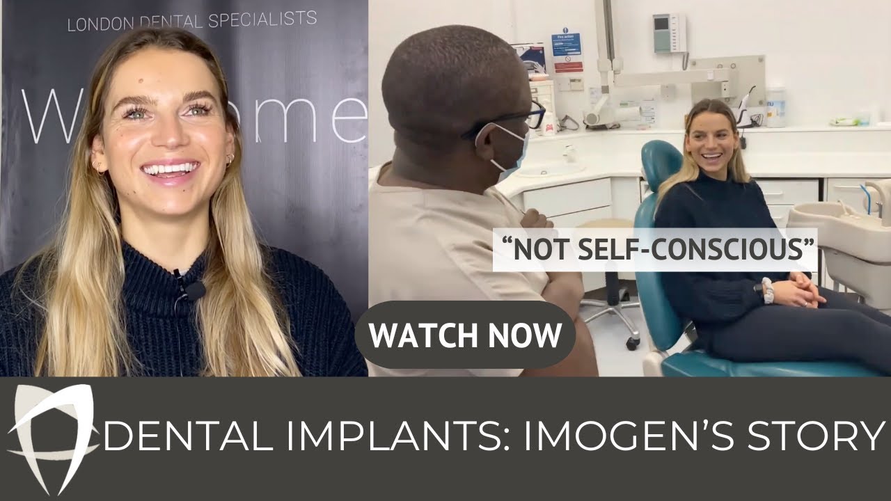 Imogen - Single Tooth Implant + Veneers/Crowns