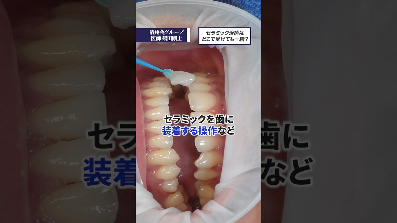セラミック治療はどこで受けても一緒？#歯医者 #セラミック #審美歯科