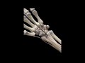 Trapeziectomy   Weilby Procedure - 3D Medical Animation