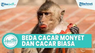 Heboh Cacar Monyet Disebut Dapat Picu Penyakit Komplikasi, Ini Cara Membedakannya dengan Cacar Air