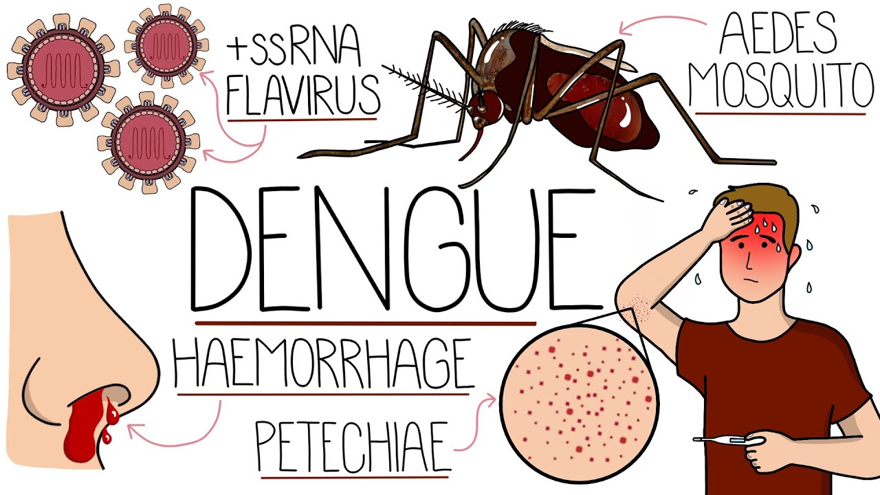 Dengue Fever Explained (Including Dengue Haemorrhagic Fever & Shock Syndrome)