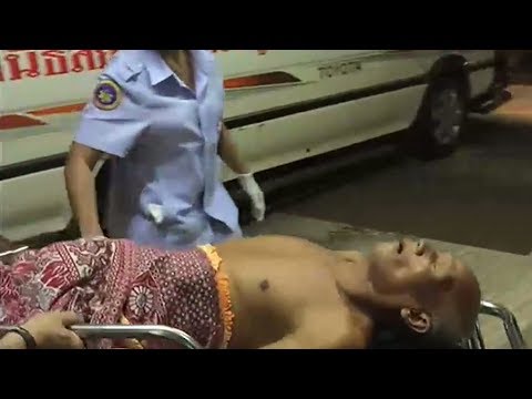 โรคสะเก็ดเงินฟุตคัน สาเหตุกลากบนใบหน้า