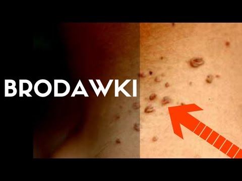 Tylko jako zwiększenie członka Mam pryszcze na skórze członka mała