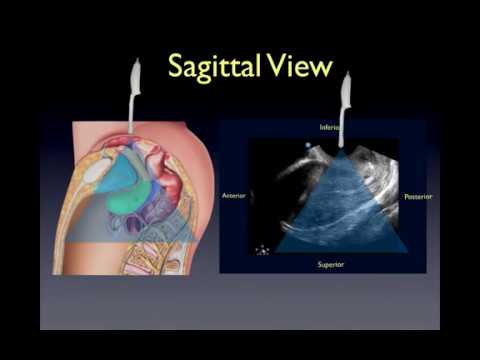 Kräuter-Einlauf von Prostatitis Prostamol russische Pendant