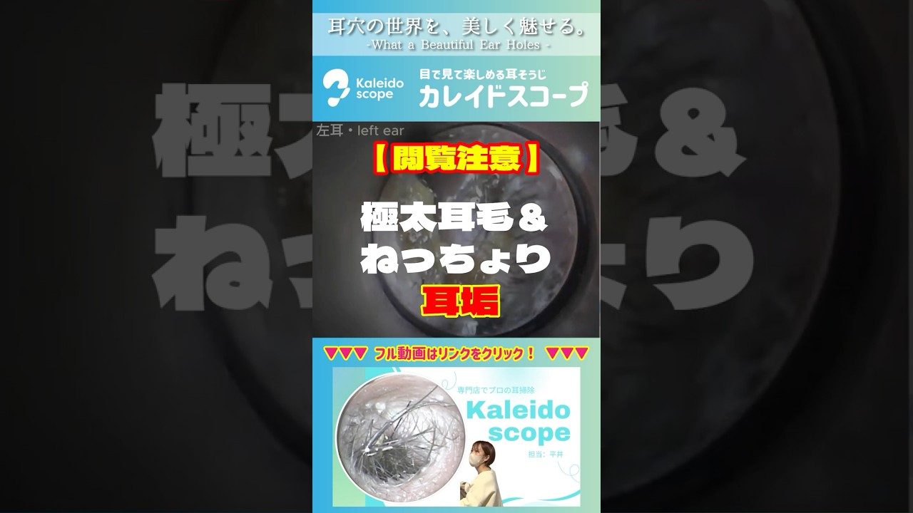 【閲覧注意】極太耳毛＆ねっちょり耳垢