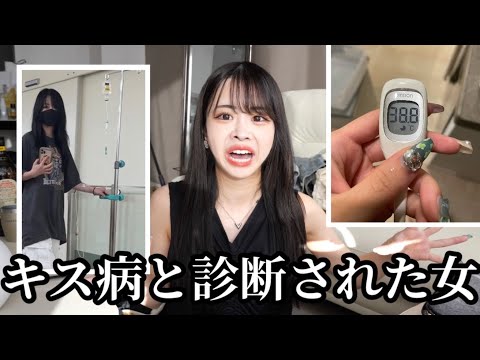 伝染性単核球症 - 定義