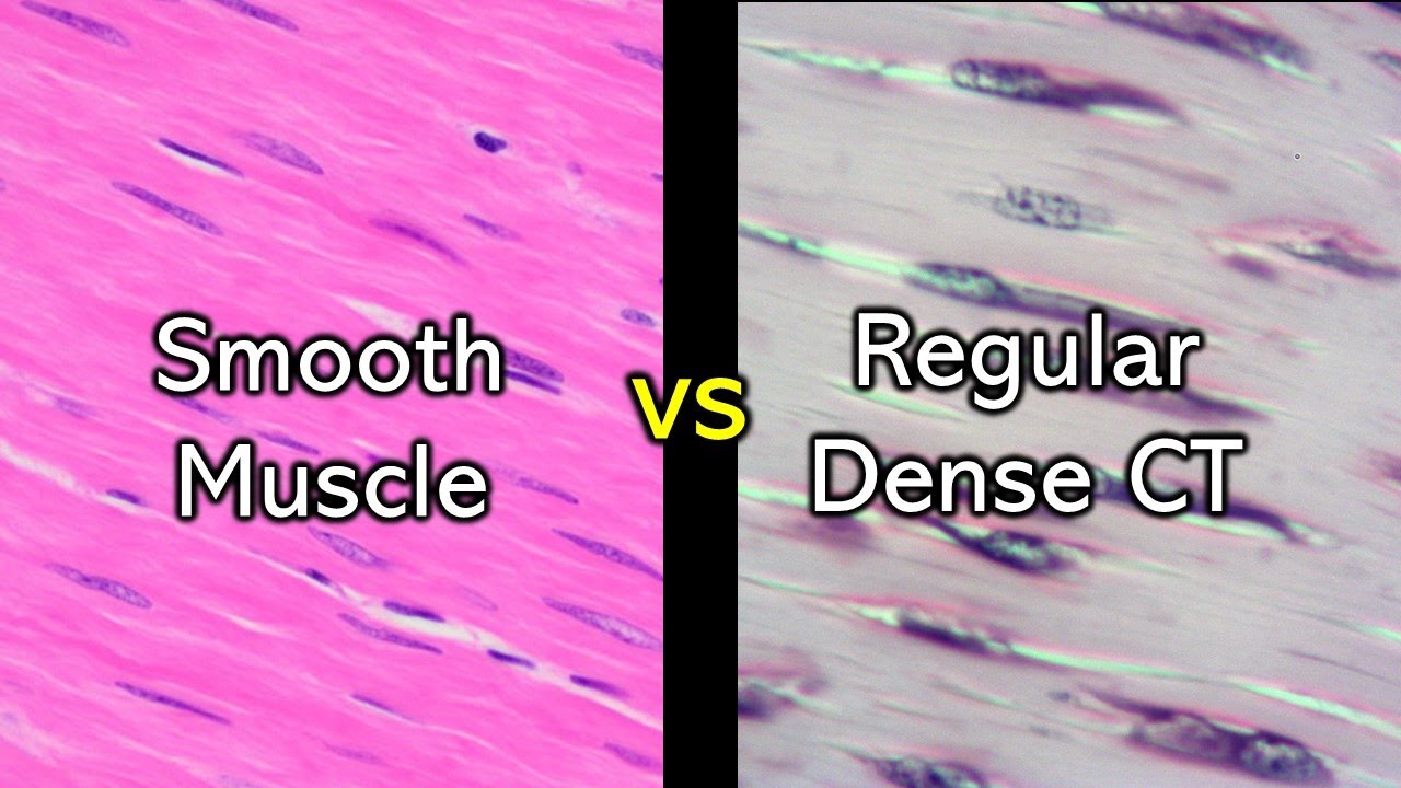 Practice | Smooth Muscle vs Dense Regular Connective Tissue