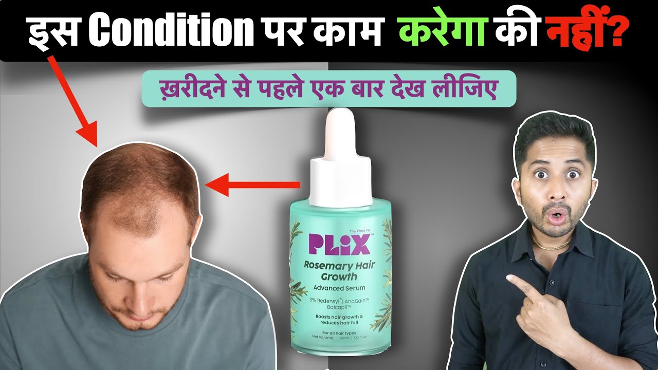 Plix Rosemary Hair Growth Serum Review - Will it Control Hair Fall?