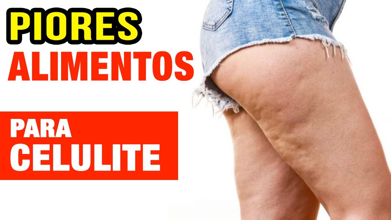 6 PIORES ALIMENTOS PARA CELULITE