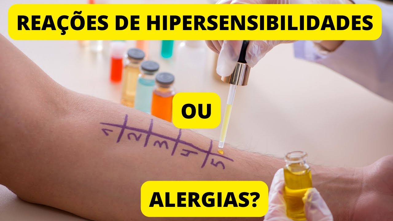 ALERGIAS OU REAÇÕES DE HIPERSENSIBILIDADES?