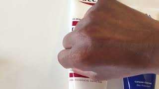 TriDerma Eczema Fast Healing Cream vs. Eucerin Eczema Relief