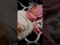 PIJAT KACANG WANITA Pijat Massage Pijatsehat Pijatperut Pijatkesehatan Pijattradisional Fyp