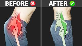 Stop Stretching Your Psoas (Do This Instead)