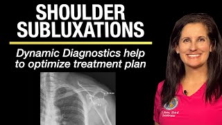 Ligament problem causing extreme shoulder instability seen on motion x ray