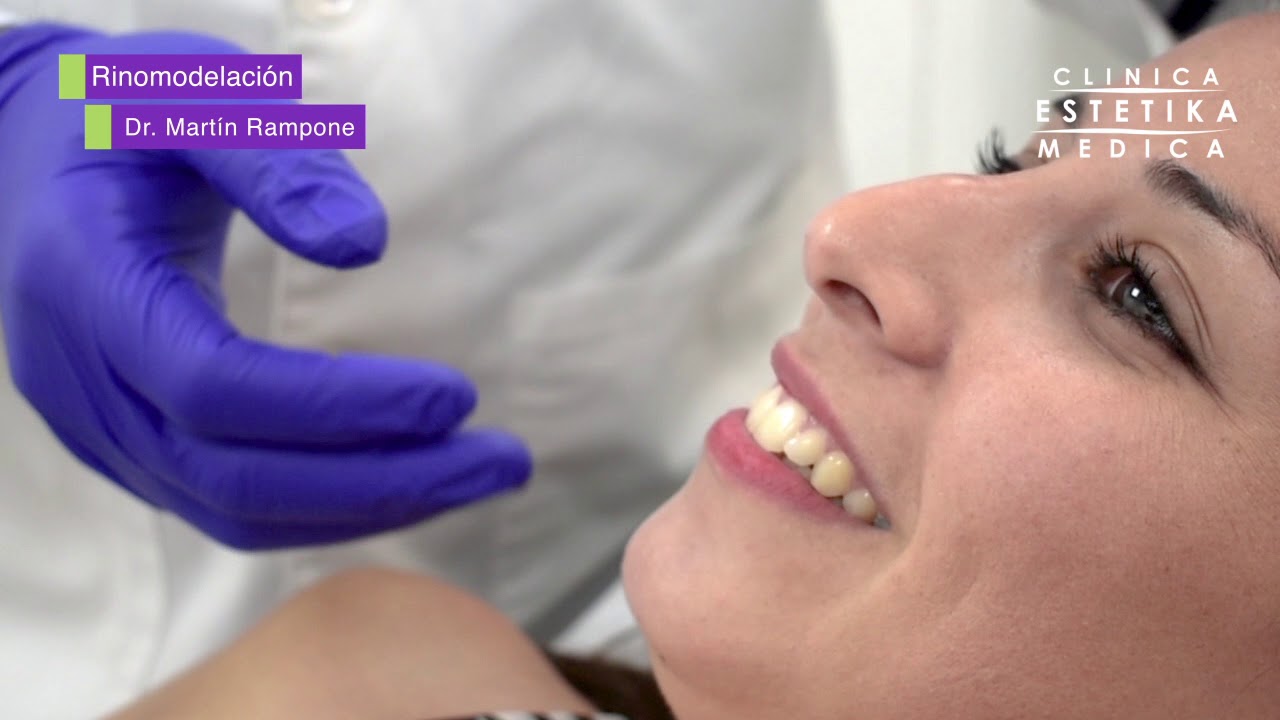 Rinomodelación en Clínica Estétika Médica Resultados