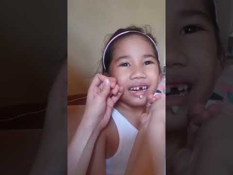 How to remove milk teeth using thread