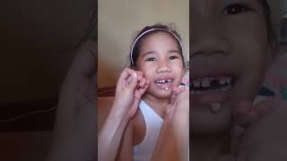 Download lagu How to remove milk teeth using thread mp3 Download lagu How to remove milk teeth using thread mp3