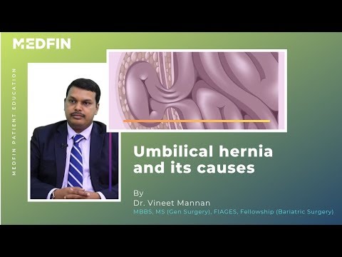 Umbilical Hernia Causes and Symptoms