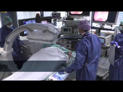 Cios Alpha in Gastroenterology – Clinical Video