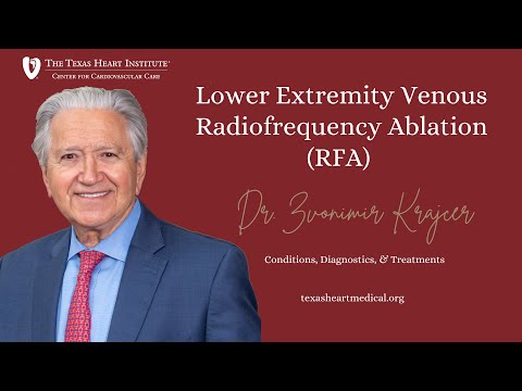 Lower Extremity Venous Radiofrequency Ablation (RFA) | Heart Information Center