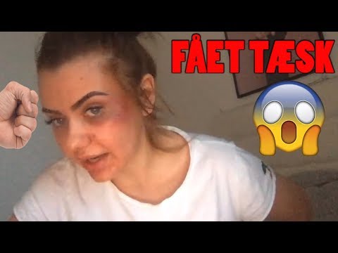 Fie Laursen Har Fået Tæsk