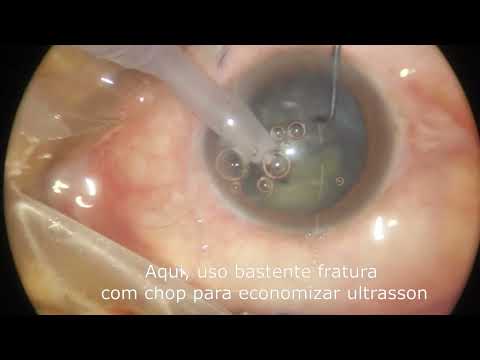 Kassio Assis-6