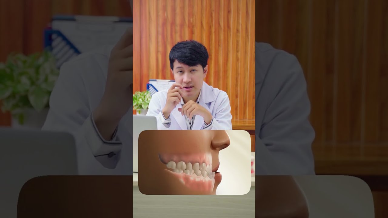 Niềng răng có giúp cải thiện tình trạng móm hay không?