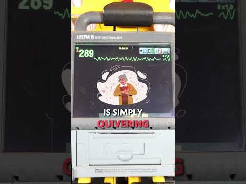 Avoid this DANGEROUS Heart Rhythm