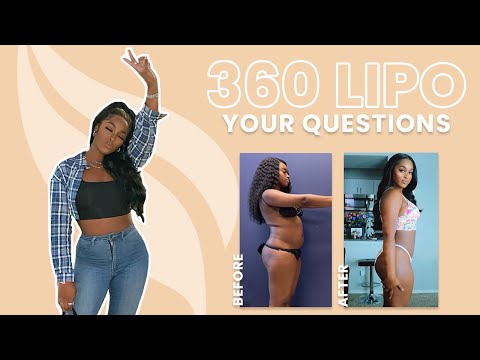 Lipo 360 Review | Taylor Answers Popular Questions About Liposuction and Fat Loss Results