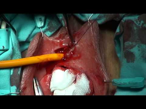 Komyakov technique of the transposition of female urethra