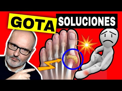 ¿Buscas REMEDIOS para la GOTA que FUNCIONEN? ¡MIRA ESTO!