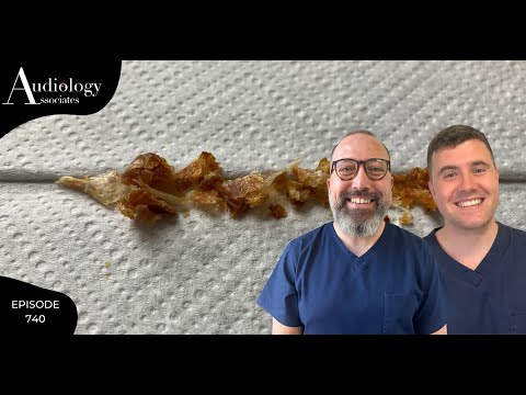 TIGHTLY PACKED HARD SKIN REMOVAL FROM EAR - EP740