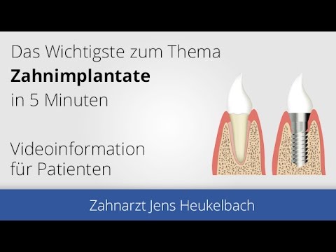 Implantate Hemhofen bei Erlangen - Zahnarzt Jens Heukelbach