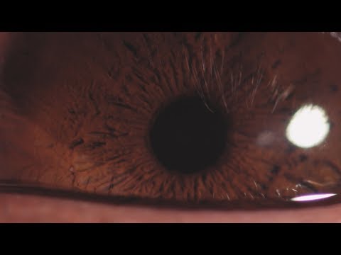 video frame placeholder