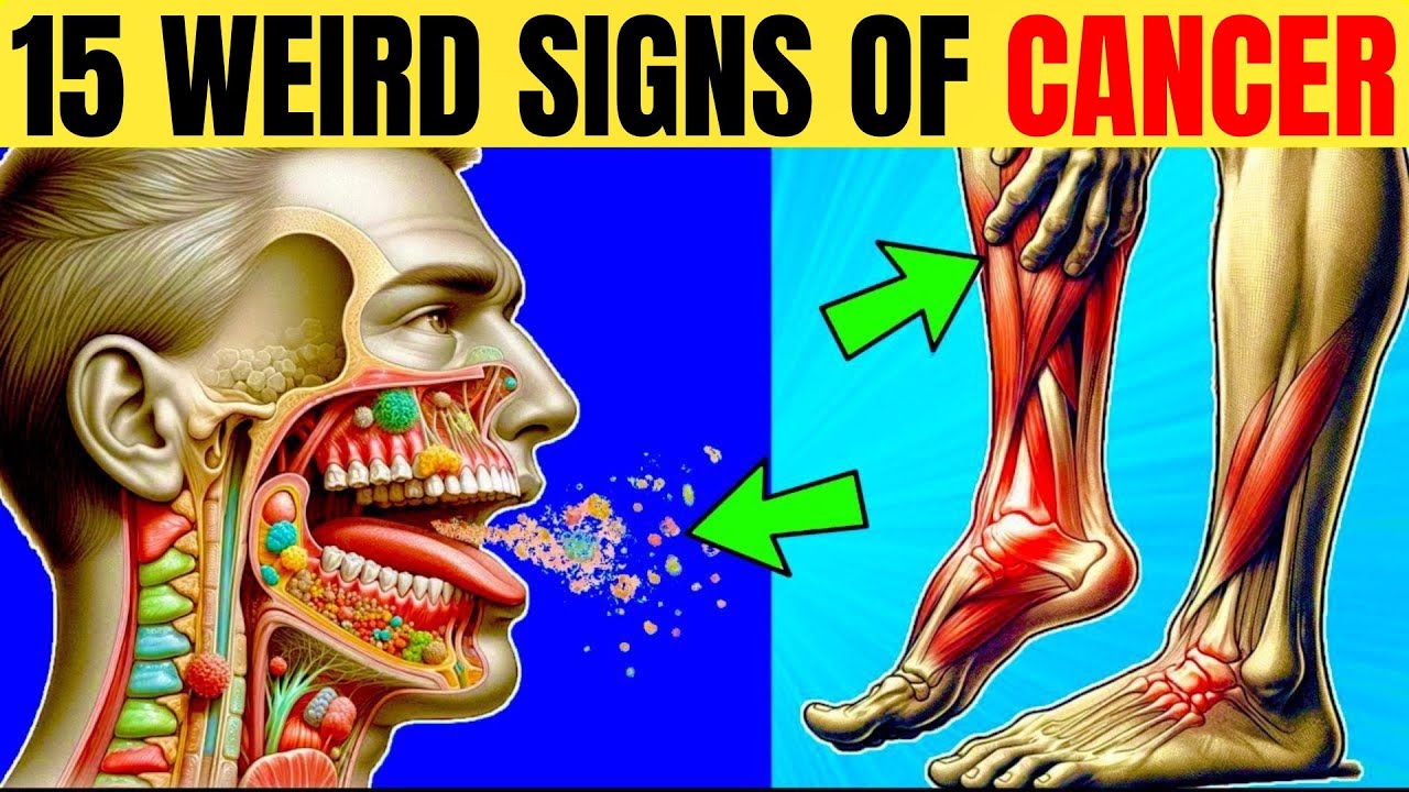 WARNING! 15 EARLY SIGNS OF CANCER MOST PEOPLE MISS! - DON’T IGNORE!