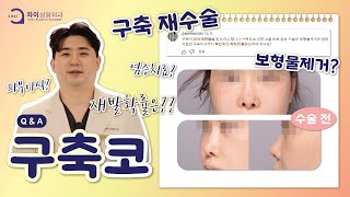 구축코 재수술과 관리 방법은?