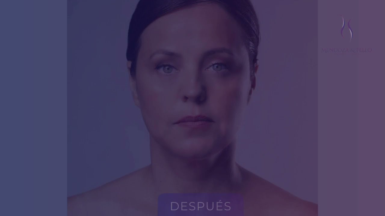 Alexander Mendoza-93