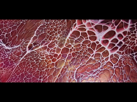 #48 Bloom Technique on 20 inch Round, Acrylic Pouring, Sheleeart