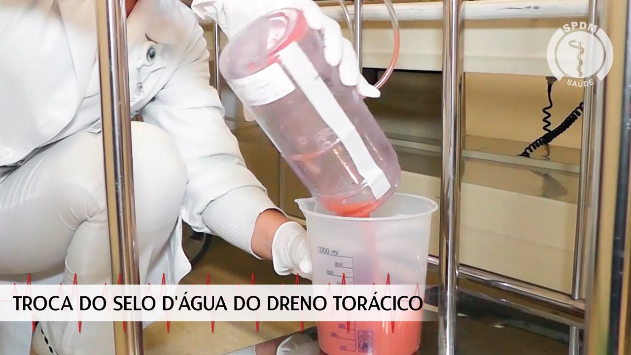 Troca do selo d'água do dreno torácico