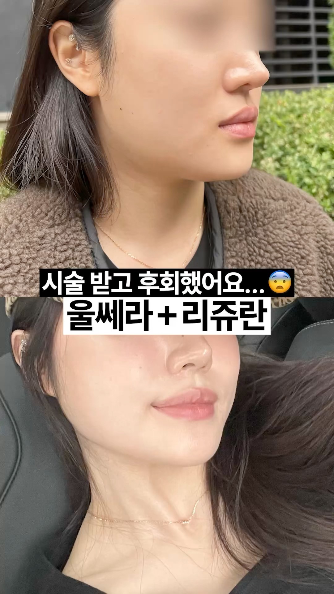 결광 피부 이거 하나만 기억하세요✅