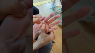 Инсулт- Как да стимулираме активното изпъване на пръстите